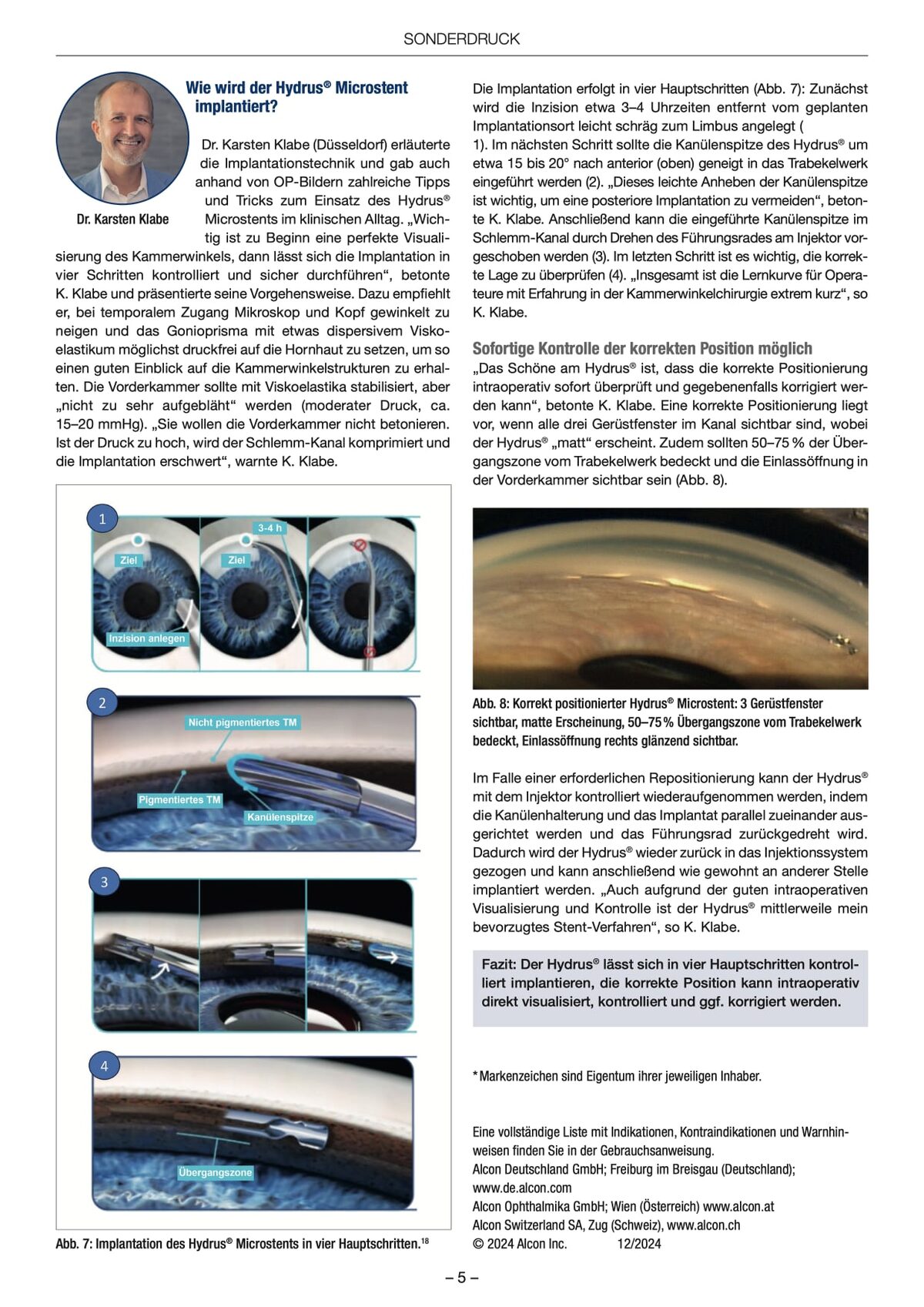 Auszug aus der Veröffentlichung in den Ophthalmologischen Nachrichten 01/2025.