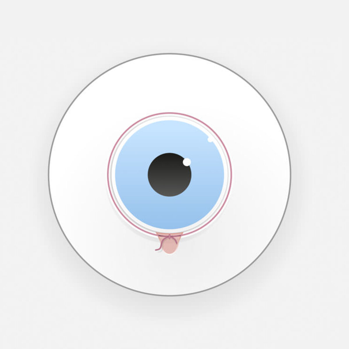 360 Grad Kanaloplastik / Canaloplasty