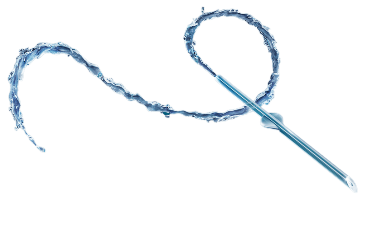Glaukomchirurgie mit XEN-Implantat und PreserFlo